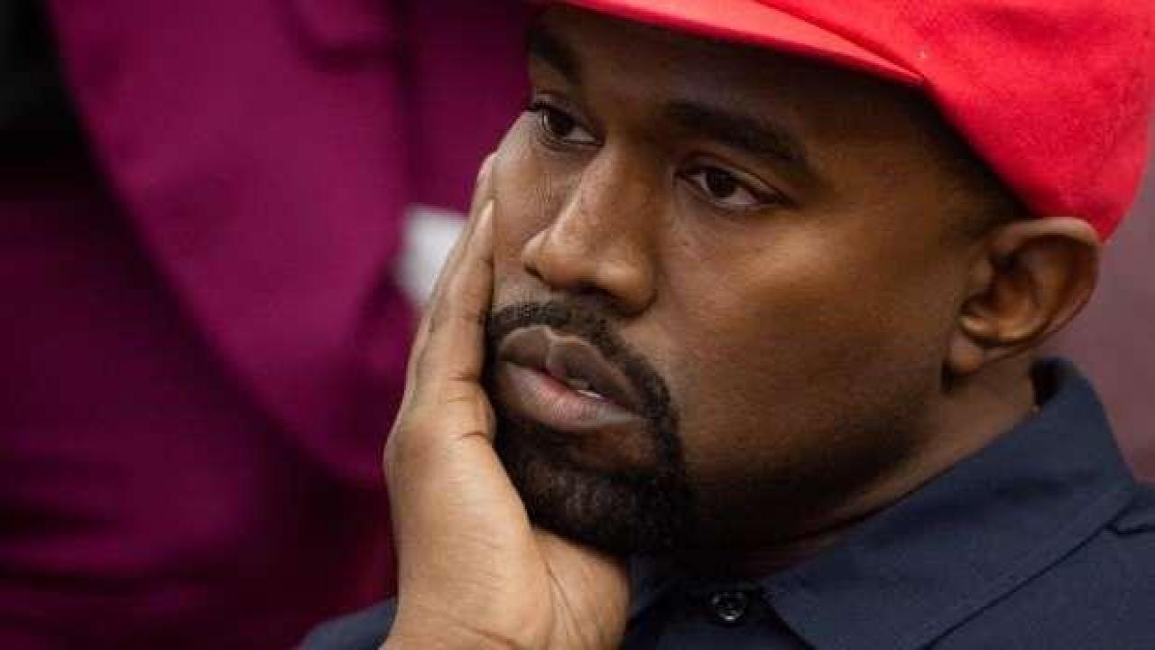 Kanye West dövmesi yaptıranlara ücretsiz sildirme imkanı