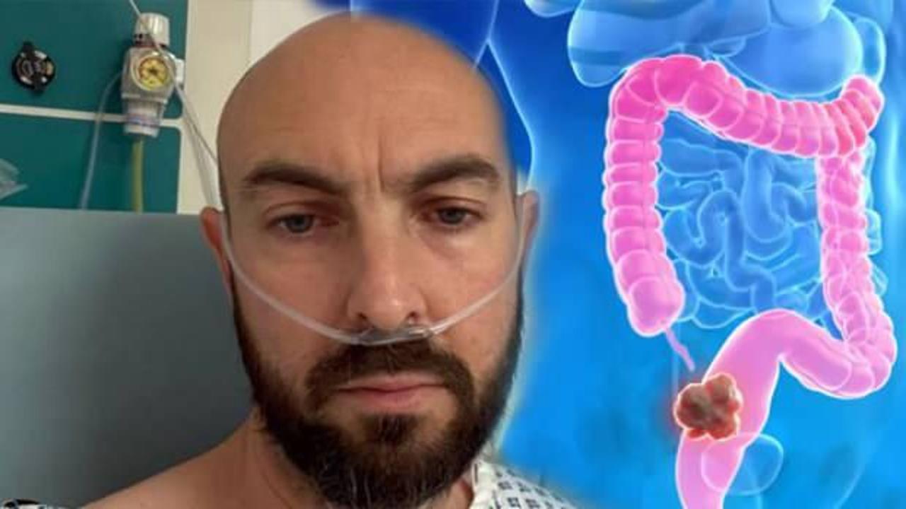 43 yaşında kolon kanseri teşhisi konuldu: 