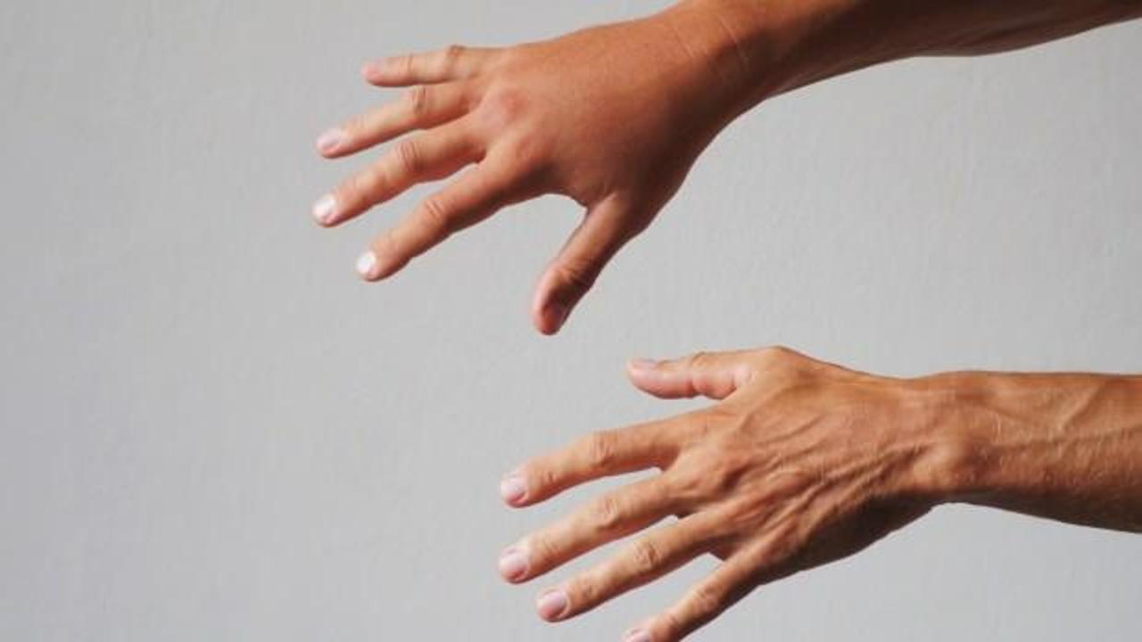 7 adımda ödemden kurtulun! Ödemden kurtulmak için ipuçları
