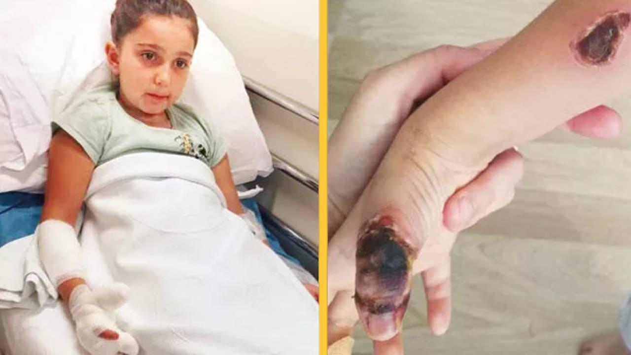7 yaşındaki Elif'i MR'da yaktılar! Doktorlara dava açıldı!