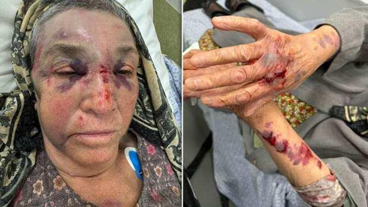 82 yaşındaki Türk, Hollandalı komşusu tarafından dövülerek hastanelik edildi