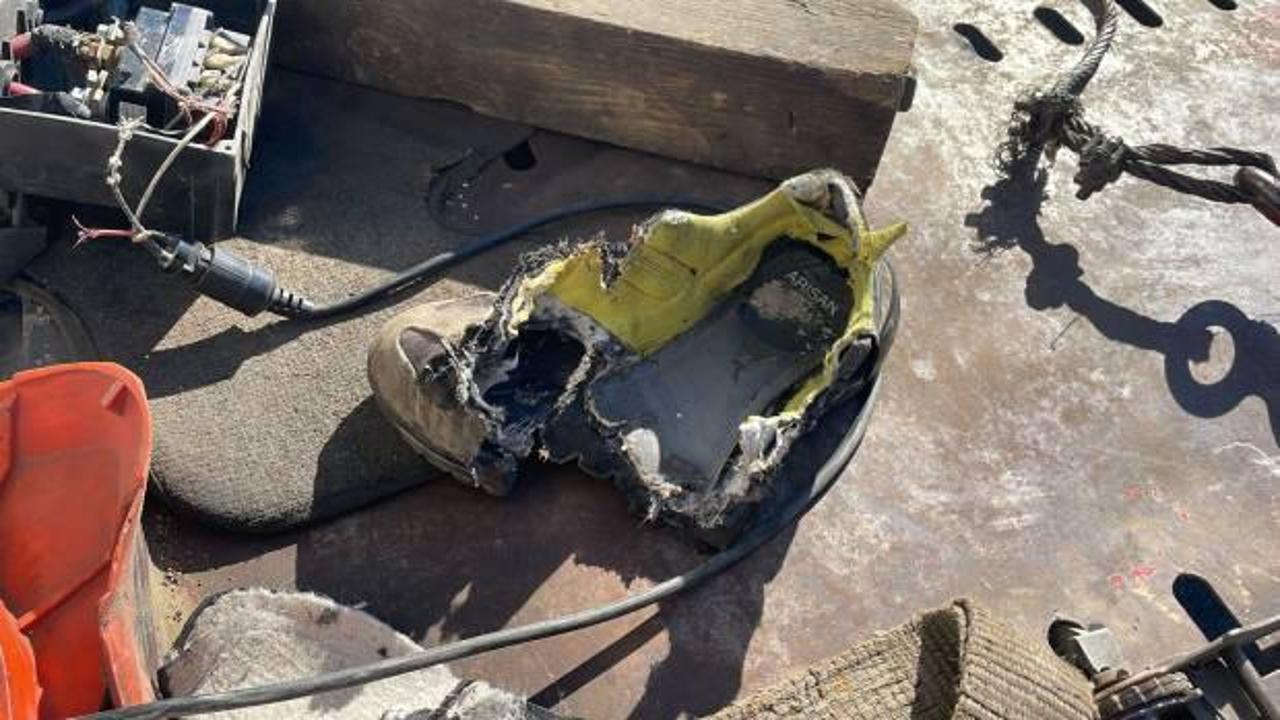 Akılalmaz kaza! Ayak parmakları koptu