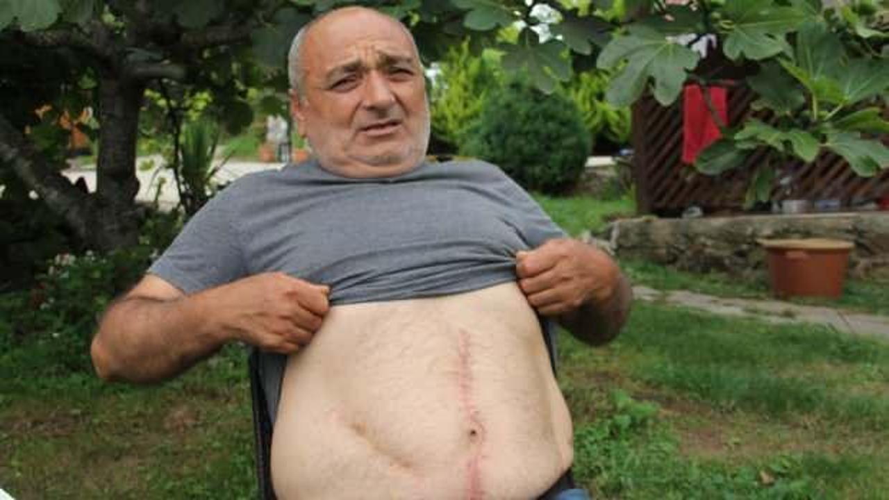 Ameliyatta unutulan gazlı bezle 18 yıl boyunca yaşadı: Yüzde 73 engelli haline geldim