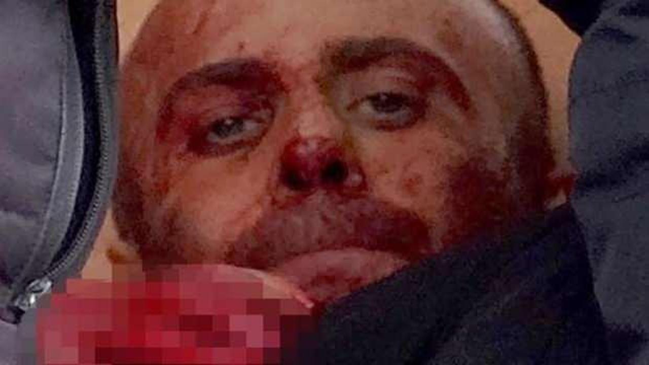 Annesini öldürdü, babasını yaraladı! Söylediği şey sayesinde iyi hal indirimi aldı