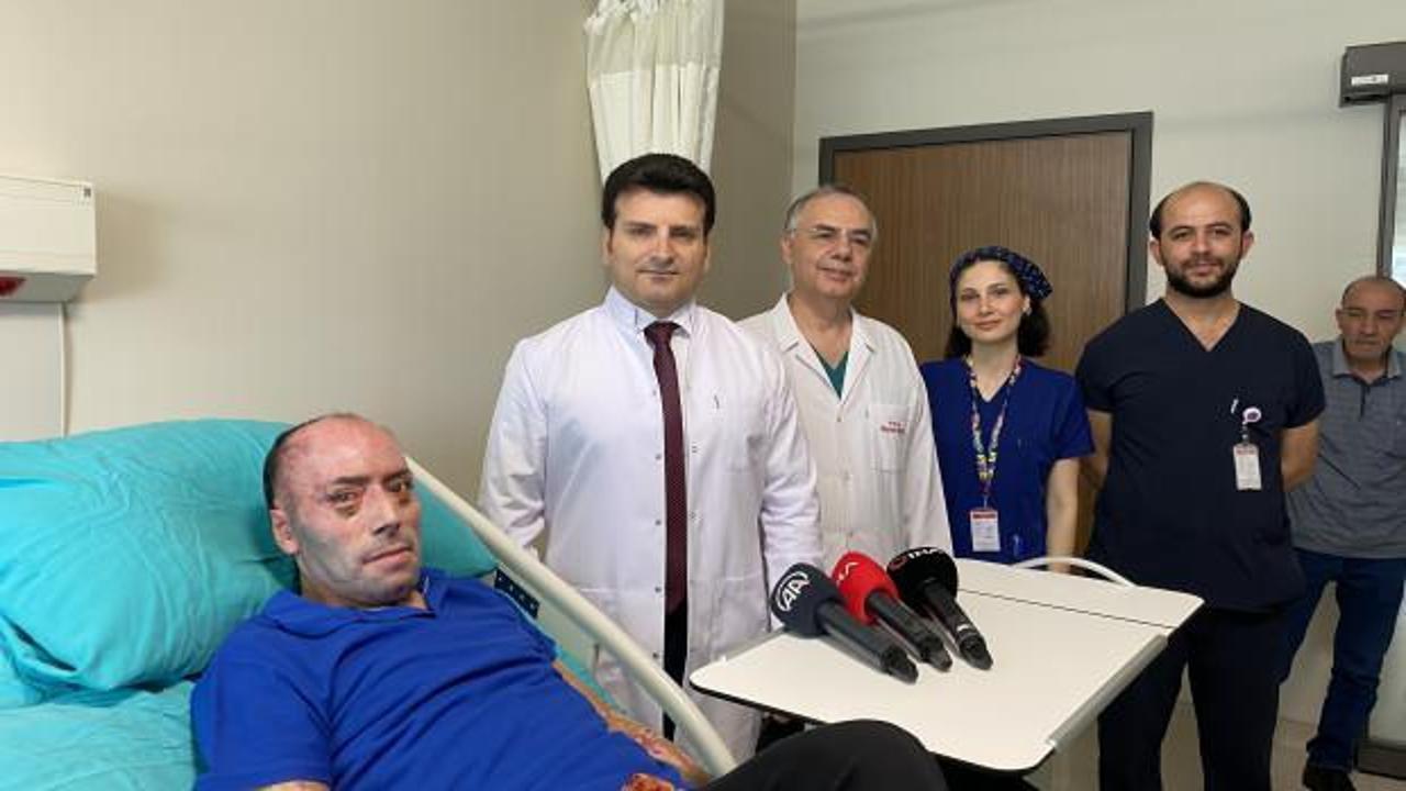 Bartın maden faciasında yaralanmıştı! 140 ameliyata giren işçi 8 ay sonra taburcu oldu!