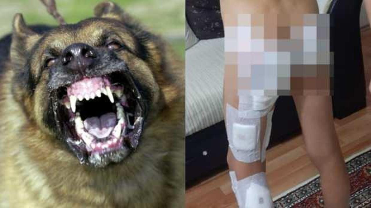 Başıboş köpek terörü bitmek bilmiyor! Küçük çocuğa dehşeti yaşattılar