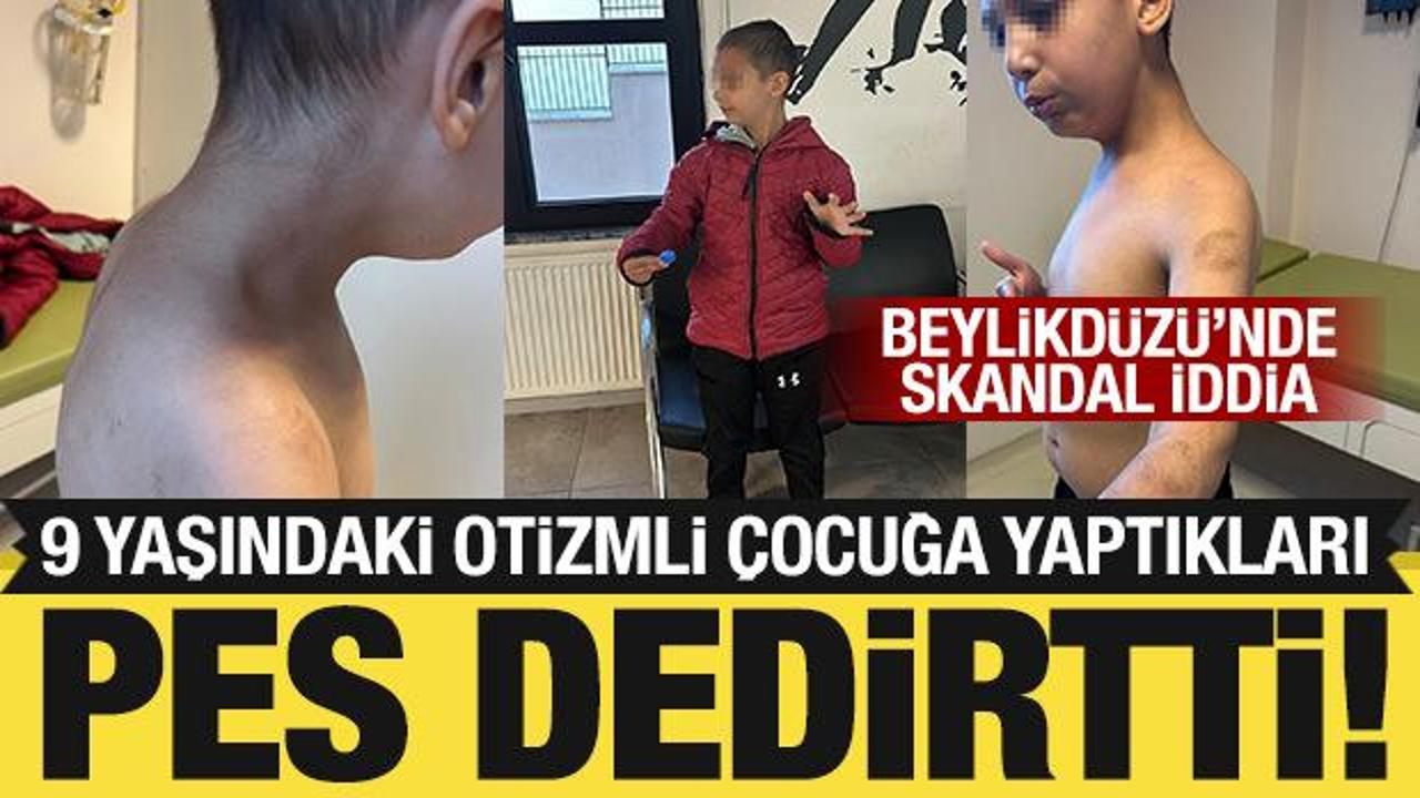 Beylikdüzü’nde özel bakım merkezinde otizmli çocuğa şiddet!