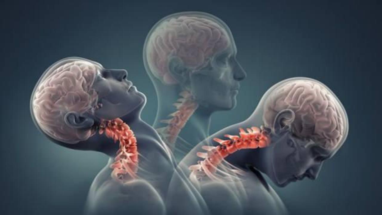 Boyun fıtığına ne iyi gelir? Boyun fıtığı egzersizleri nelerdir? Boyun fıtığı belirtileri…