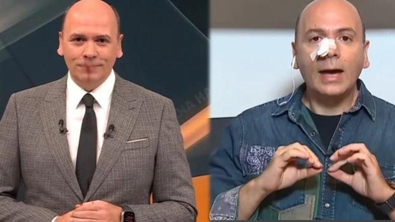 Canlı yayında burnu kanamıştı! Cem Öğretir, durumunu açıkladı