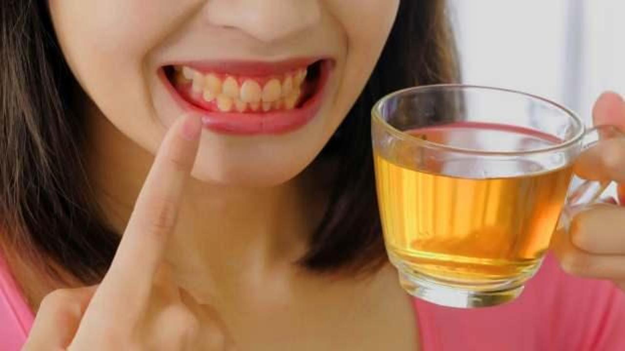 Çay yüzünden sararan dişlere çözüm: Diş lekeleri nasıl geçer?