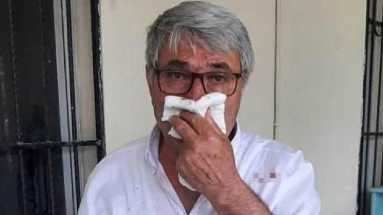 CHP'den muhtarı darbeden belediye başkan yardımcısına soruşturma