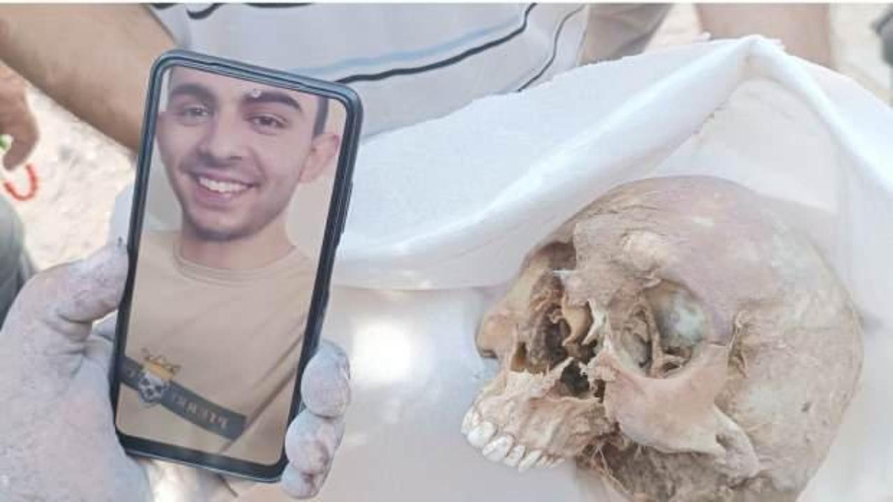 Cibaliye'de iskelet haline gelen oğullarını dişlerinden tanıdılar