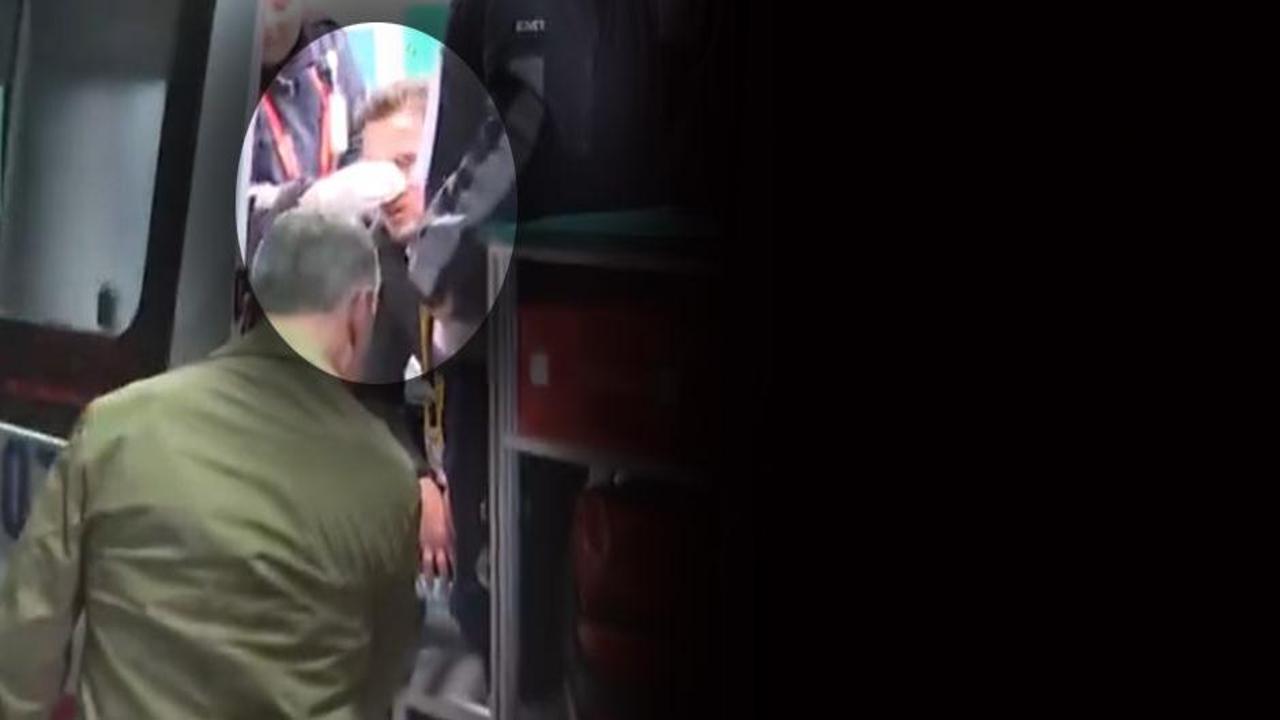 Derbi sonrası gazeteciye çirkin saldırı: Burnu kırıldı