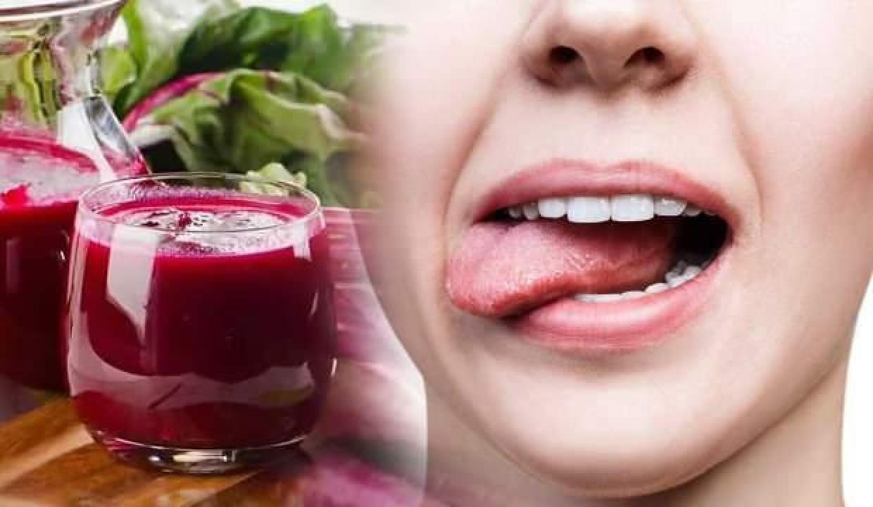 Dil yarası kaç günde geçer? Şalgam suyu dil yarasına iyi gelir mi?