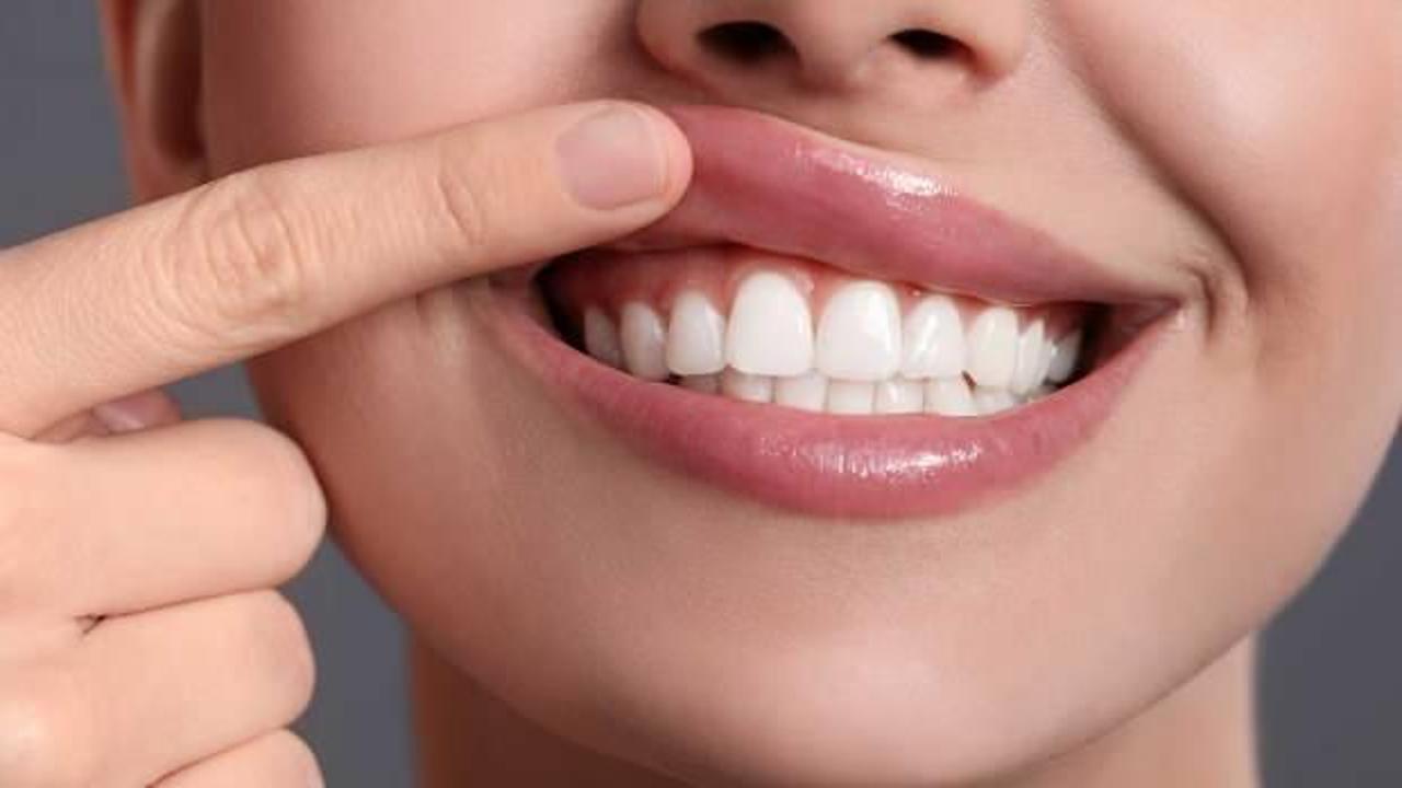 Diş çürüğü deyip geçmeyin! ''Bağırsakta adeta yangın çıkarıyor'' diyerek herkesi uyardı