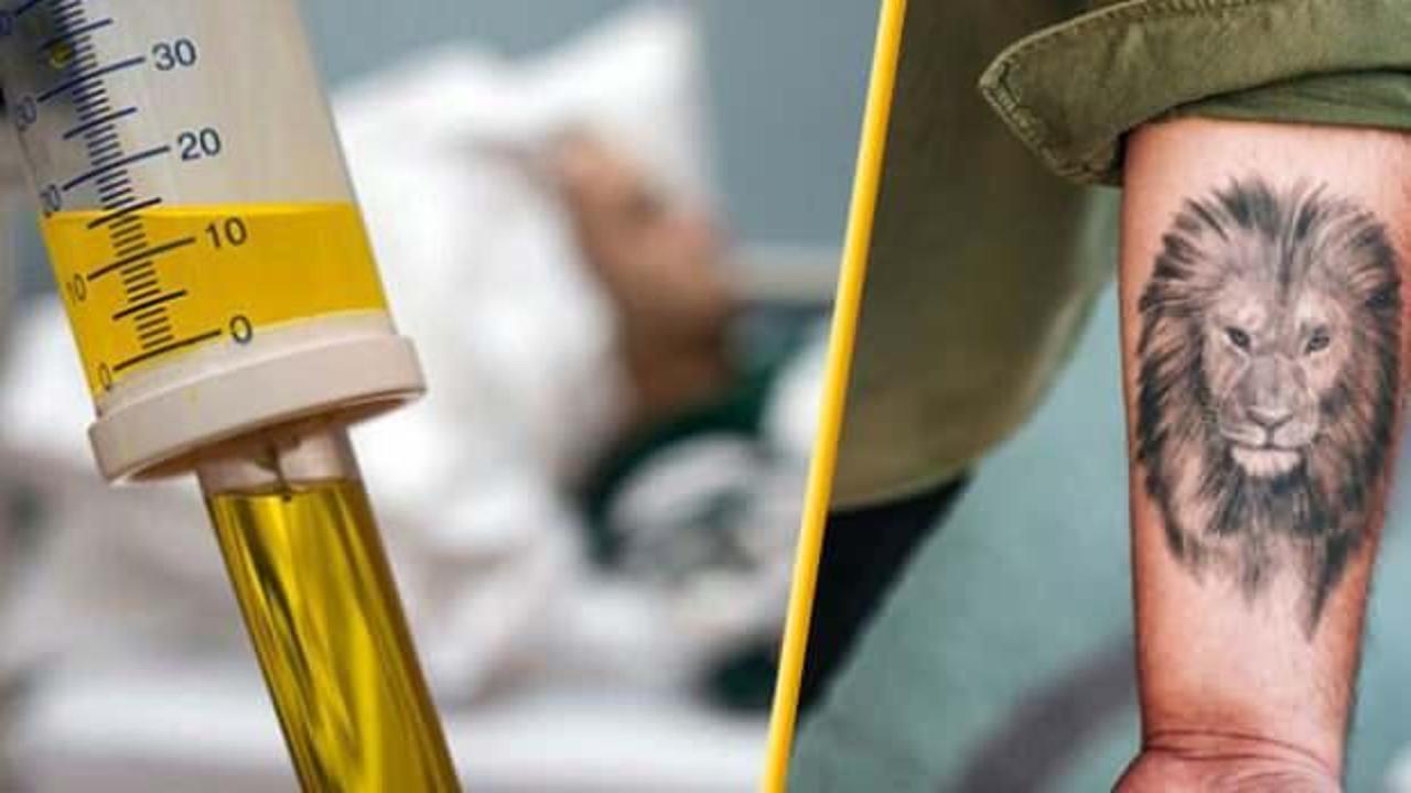 Dövme yaptıracaklar dikkat: Dövme kanser riskini artırıyor!