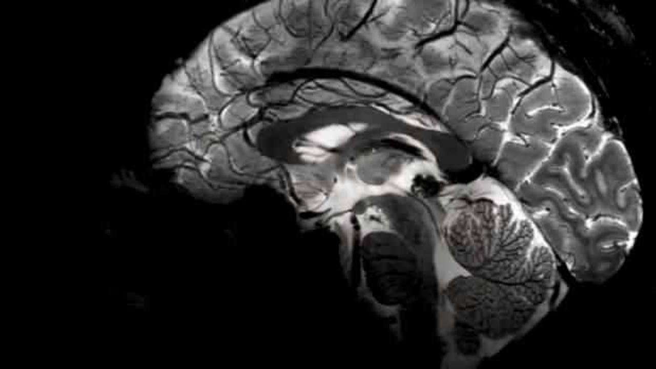 Dünyanın en büyük MRI cihazıyla çekildi: İnsan beyni ilk kez bu kadar net görüntülendi...