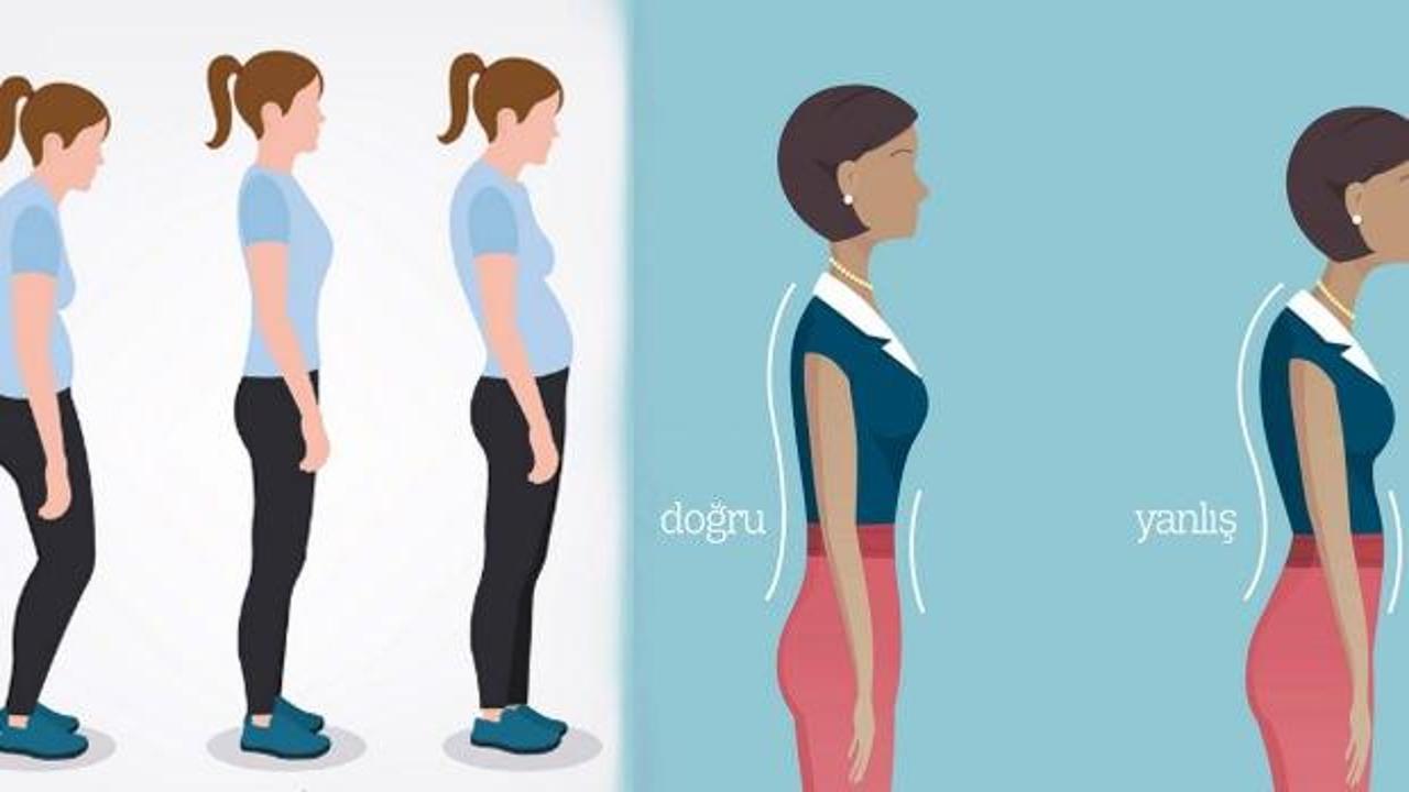 Duruş bozukluğu düzelir mi? Duruş bozukluğu belirtileri ve tedavisi…