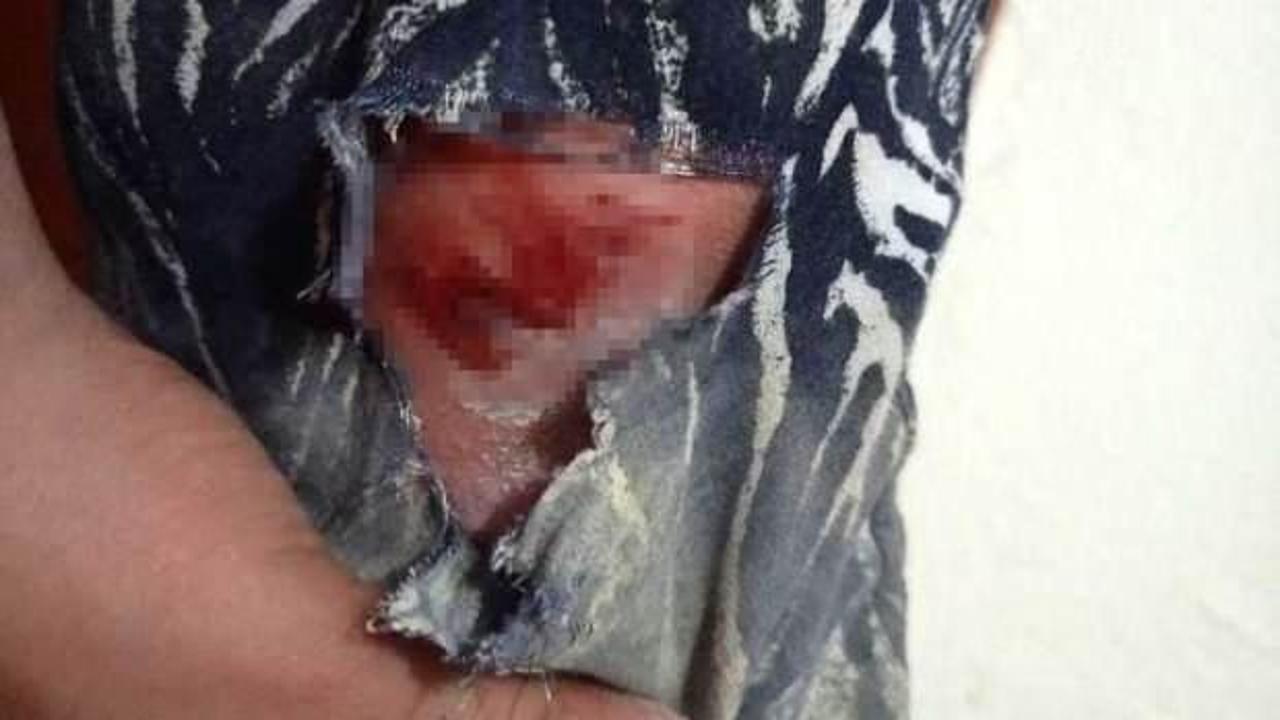 Elazığ’da başıboş köpeklerin kovaladığı şahıs yaralandı