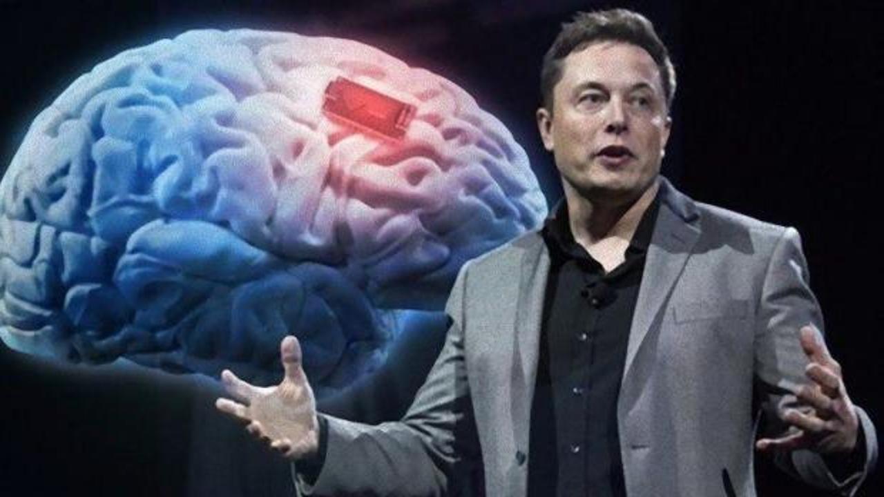Elon Musk tarih verdi... İlk defa bir insan üzerinde deneyecekler!