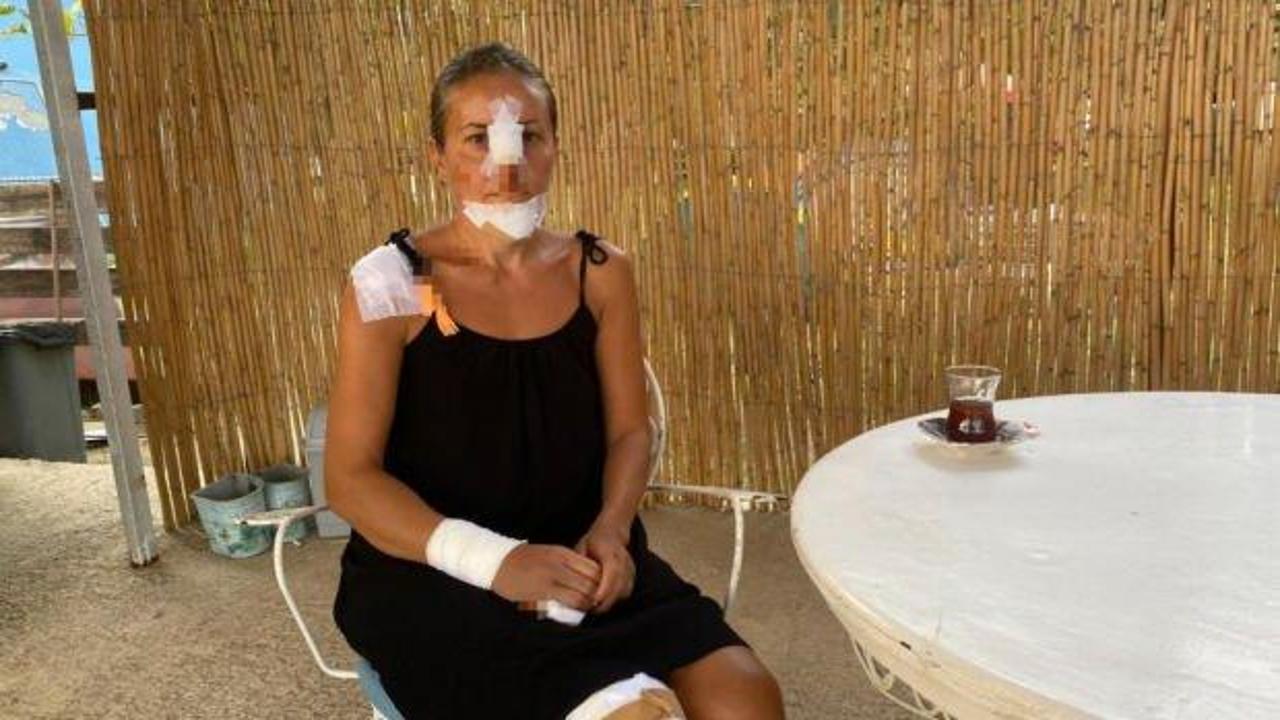 Erdek'te sokak köpeklerinin saldırısına uğrayan kadın ve kızı scooterdan düştü