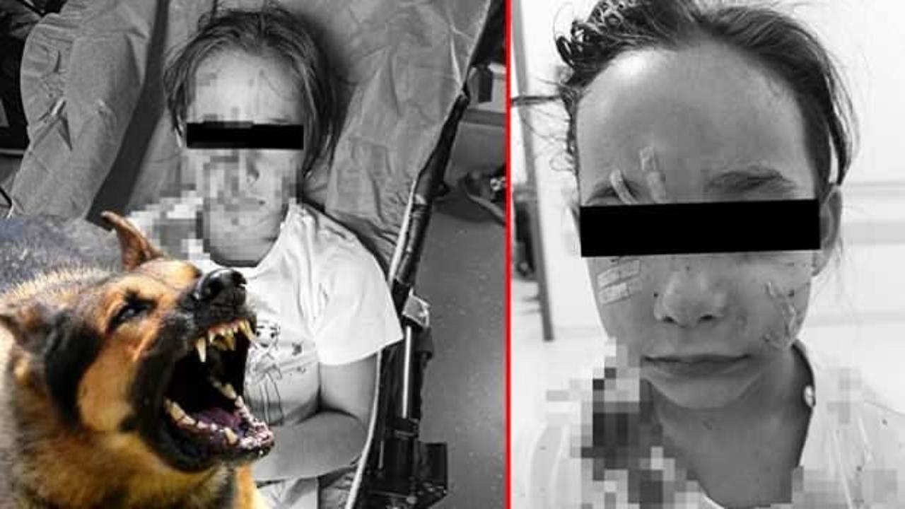 Esenyurt'ta başıboş köpek vahşeti: Kız çocuğuna dehşeti yaşattı! Valilikten açıklama