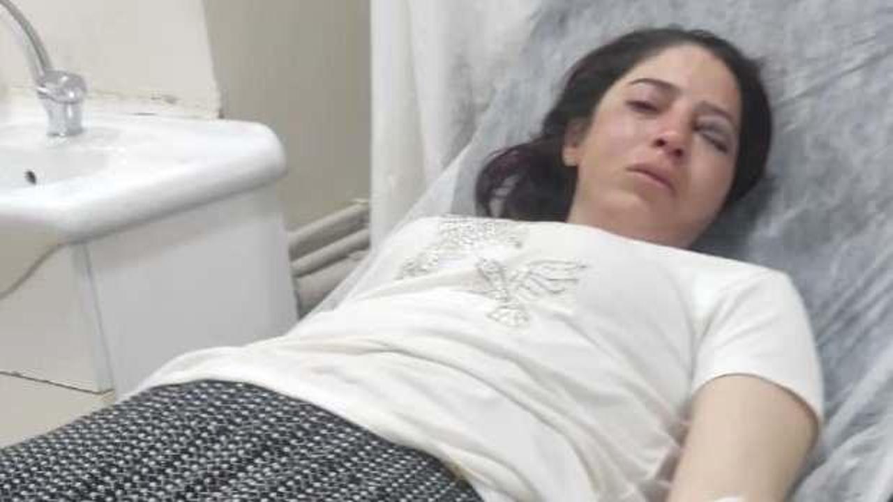 Eşinden şiddet gören kadını bir de kardeşi dövdü