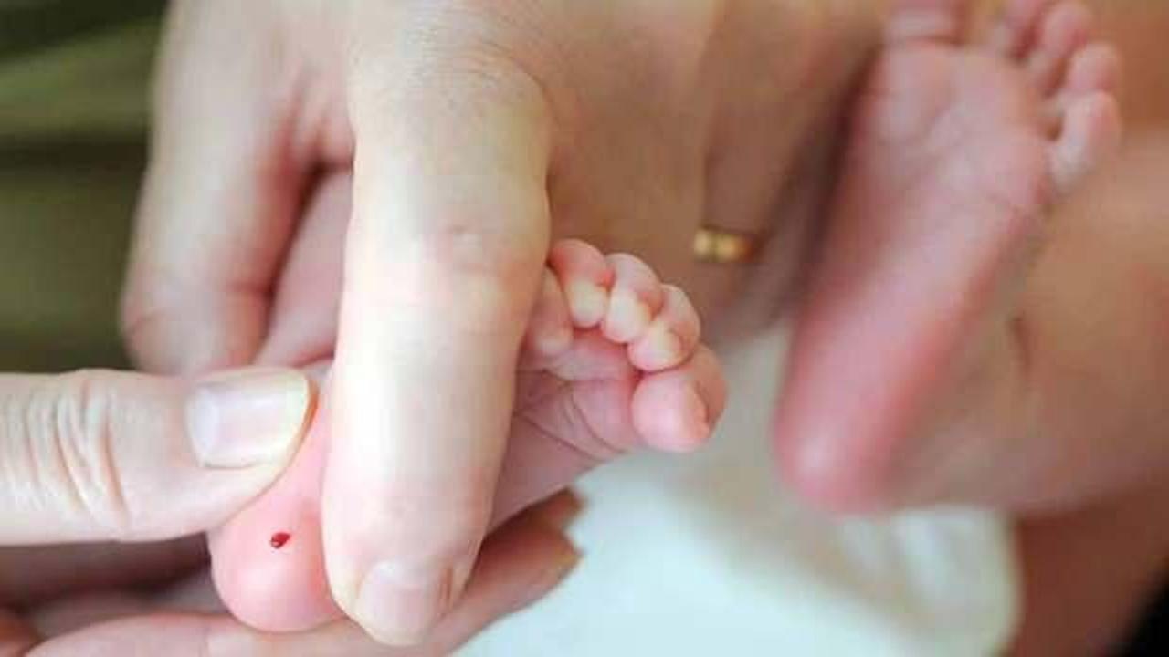 Fenilketonüri hastalığı nedir, belirtileri nelerdir? Bebeklerde fenilketonüri hastalığı tedavisi