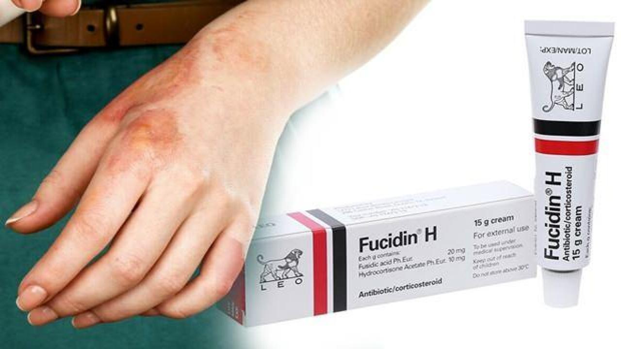 Fucidin krem ne için kullanılır? Fucidin krem sivilceye için kullanılır mı? Fucidin krem 2022 fiyatı...