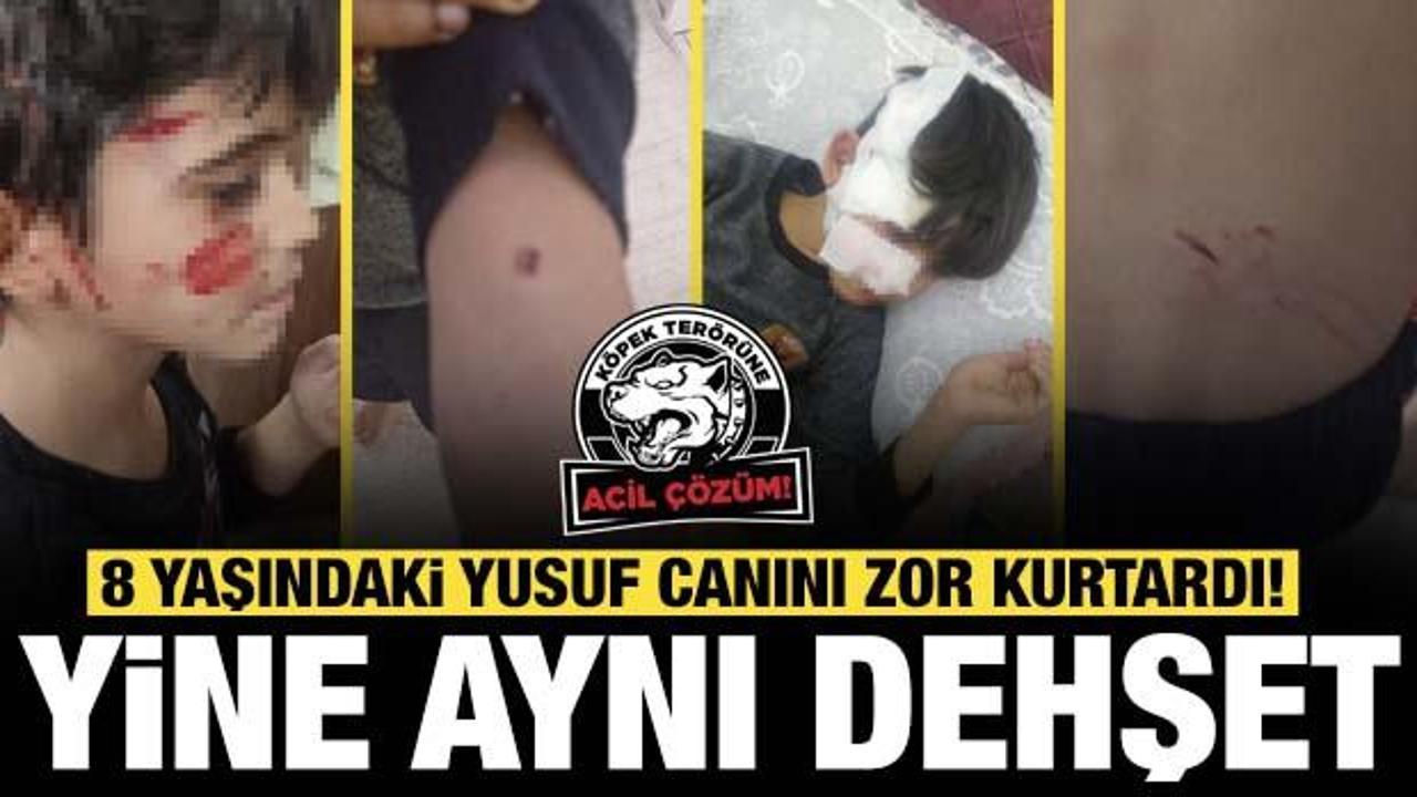 Gaziantep'te 8 yaşındaki çocuğa 5 sokak köpeği saldırdı
