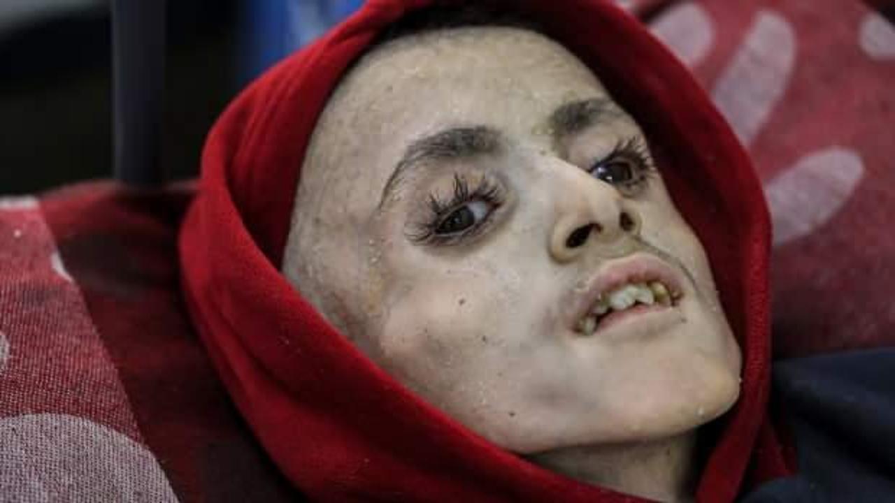 Gazze'de 13 çocuğun açlıktan ölmesi sonrası Hamas dünyaya isyan etti
