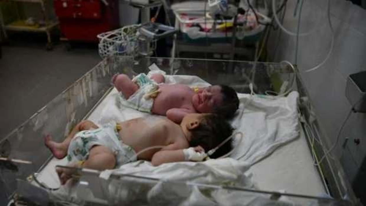 Gazze'de 2 bebek açlıktan öldü