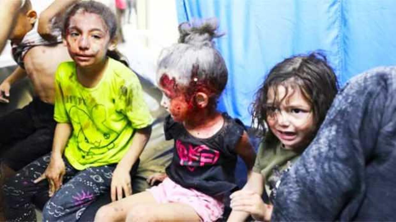 Gazze'de ameliyatlar anestezisiz yapılıyor: Ya bu acıyı çekecekler ya da ölecekler