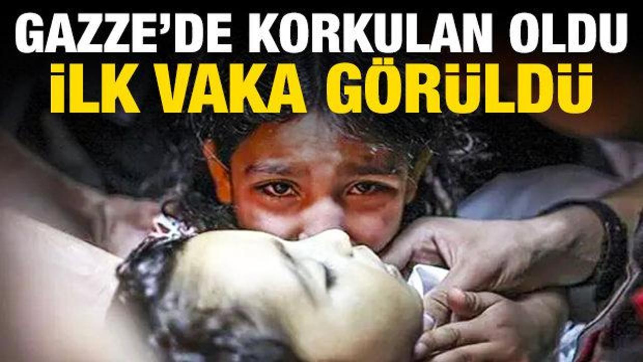 Gazze'de korkulan oldu, ilk vaka görüldü