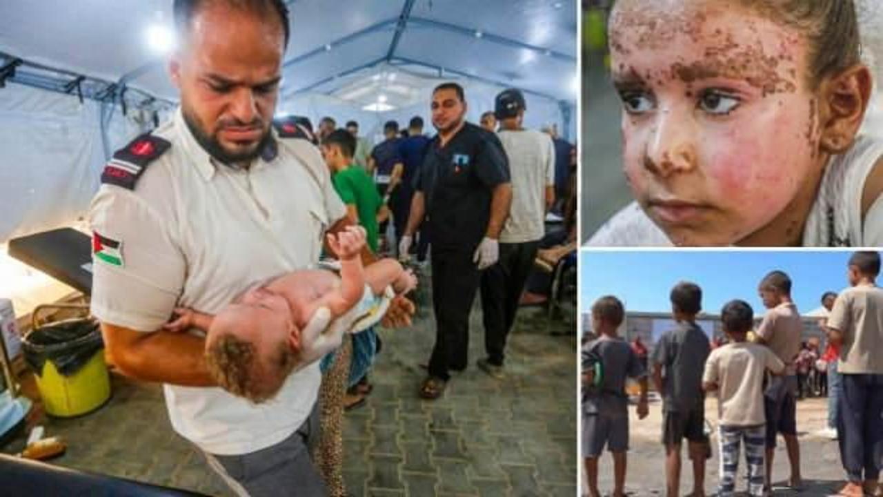Gazze'de yeni tehlike: Çocuk felci