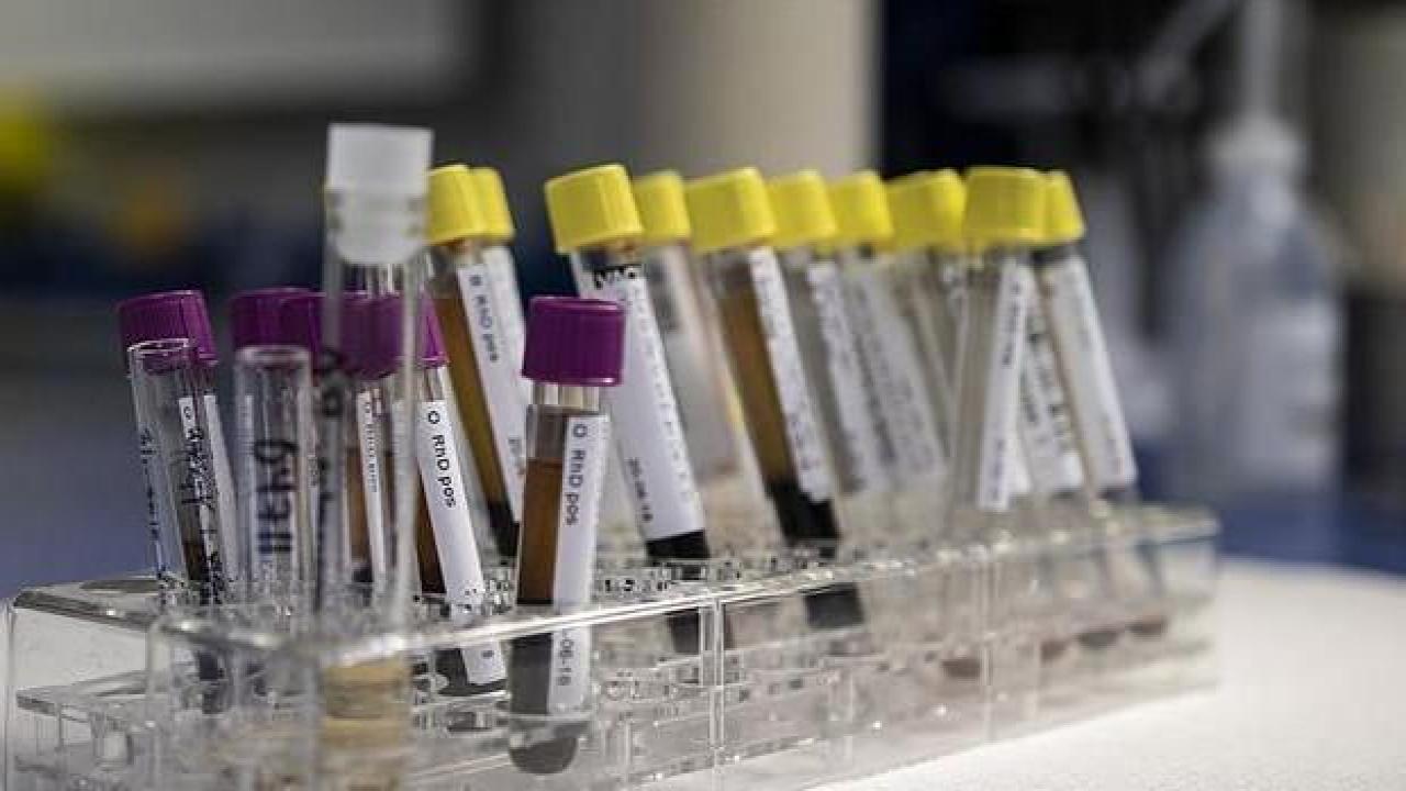 Gizemli hepatit virüsü bir ülkede daha görüldü