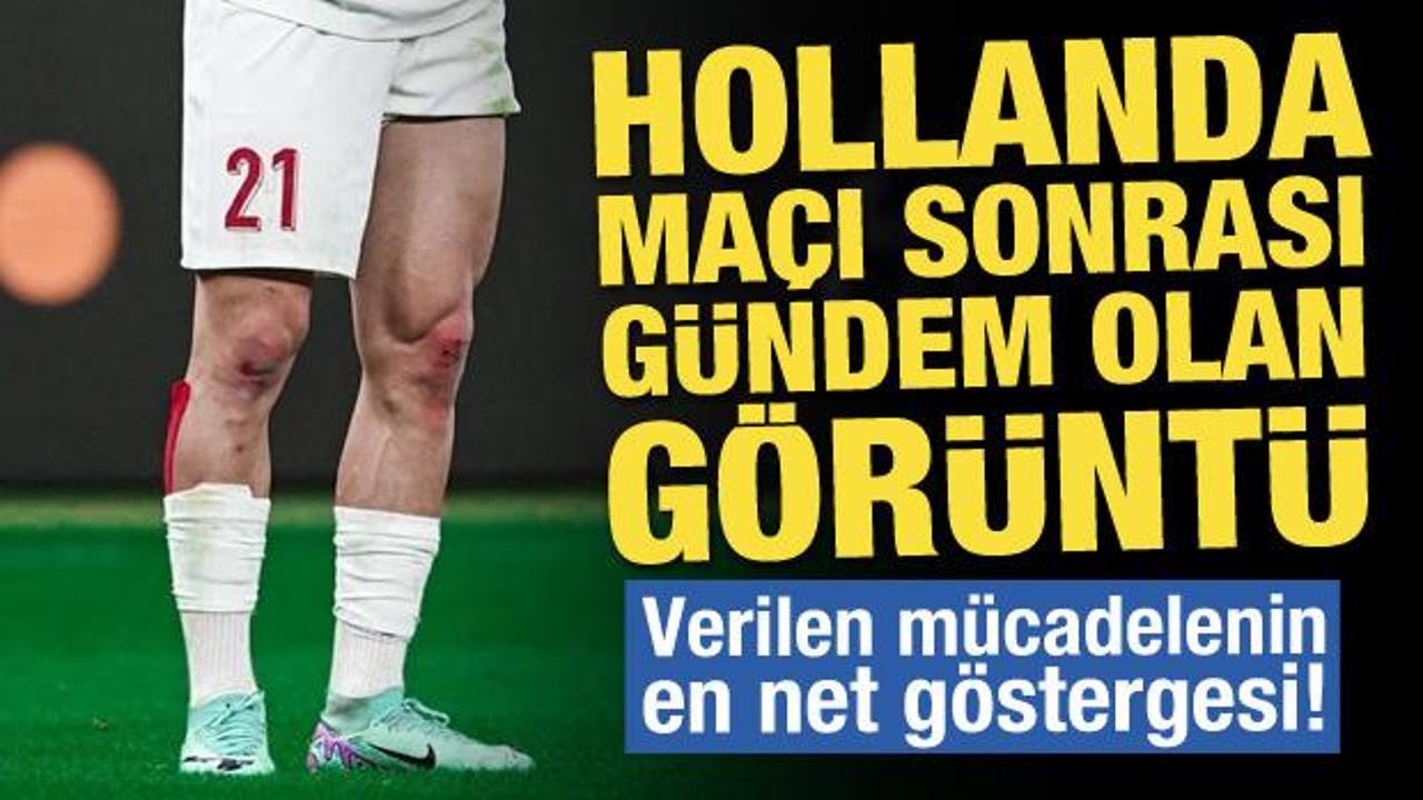 Hollanda maçı sonrası gündem olan görüntü! Verilen mücadelenin göstergesi