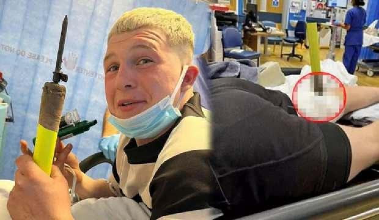 İnanılmaz sakatlık! Korner direği bacağına saplandı