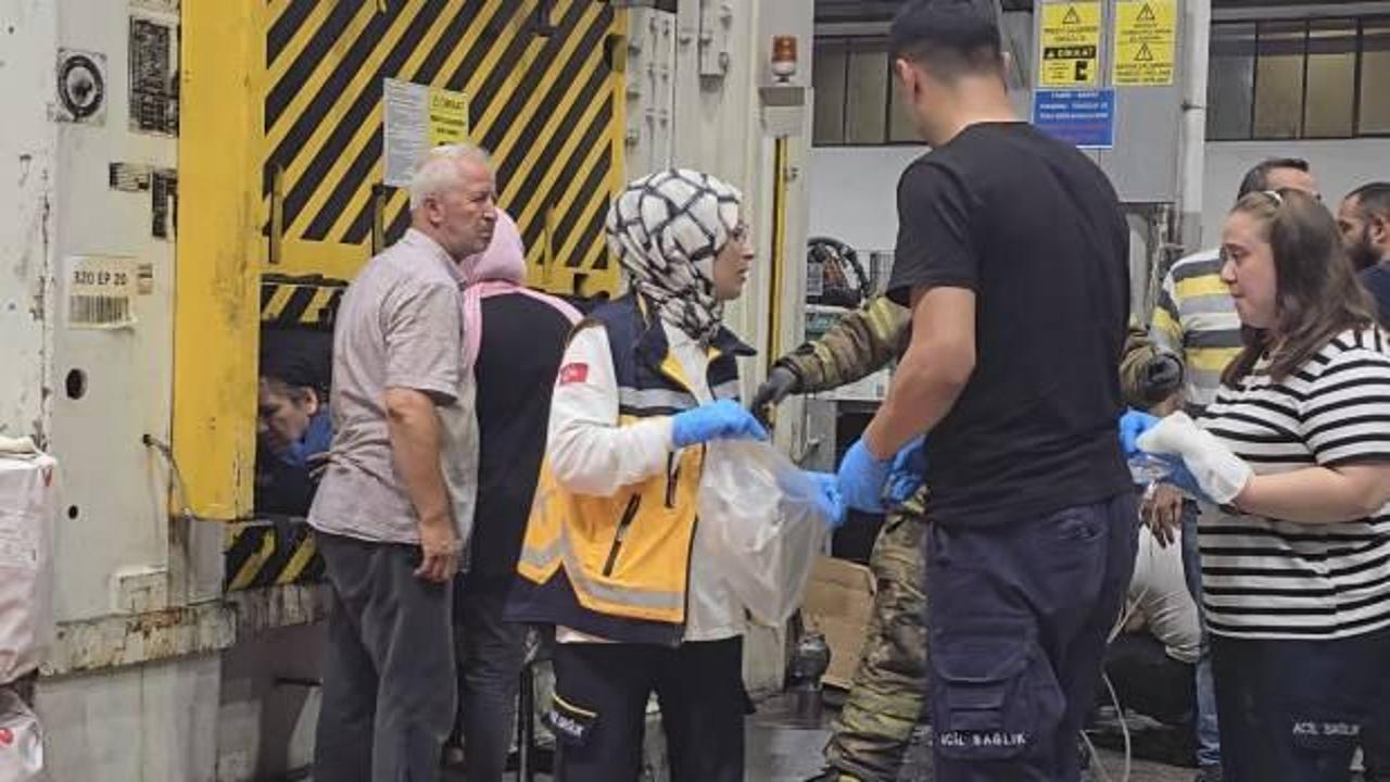 İstanbul'da feci olay! Kadın işçinin eli koptu