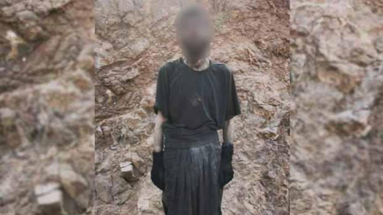PKK'lı teröristlerin açlıktan bağırsakları delindi