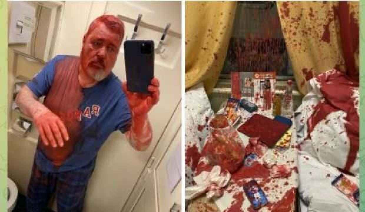 Rusya’da Nobel Barış Ödüllü muhalif gazete yöneticisine kırmızı boyalı saldırı