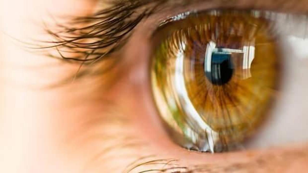 Sarı nokta hastalığı nedir, tedavisi var mı?  Gözde sarı nokta hastalığı neden olur?