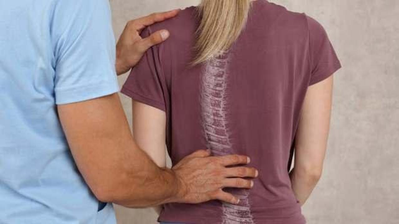 Skolyoz nedir, belirtileri nelerdir? Skolyoz hastalarının tedavisi