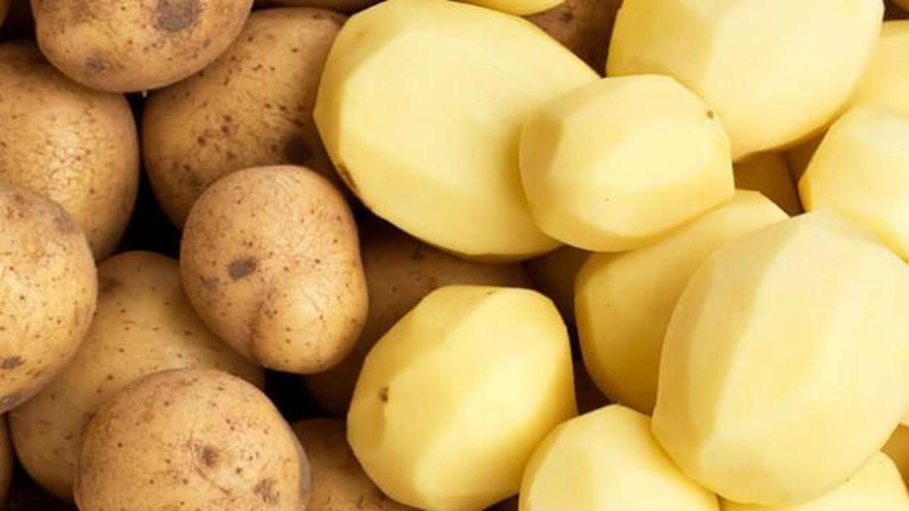 Soyulmuş patatesin kararmasını önlemek için neler yapmalısınız?