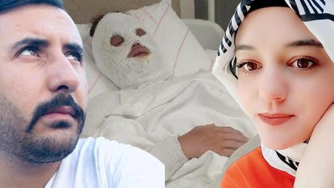 'Su sayacına bakacağız' dedi, yüzüne kimyasal attı! '15 yıl ceza' ile ilgili yeni karar