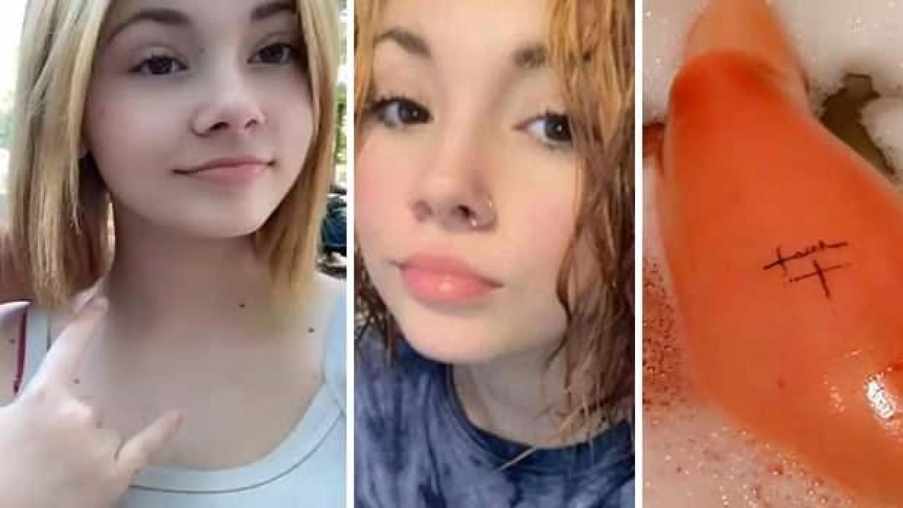 Suya alerjisi olan kızın hayatı kabusa döndü