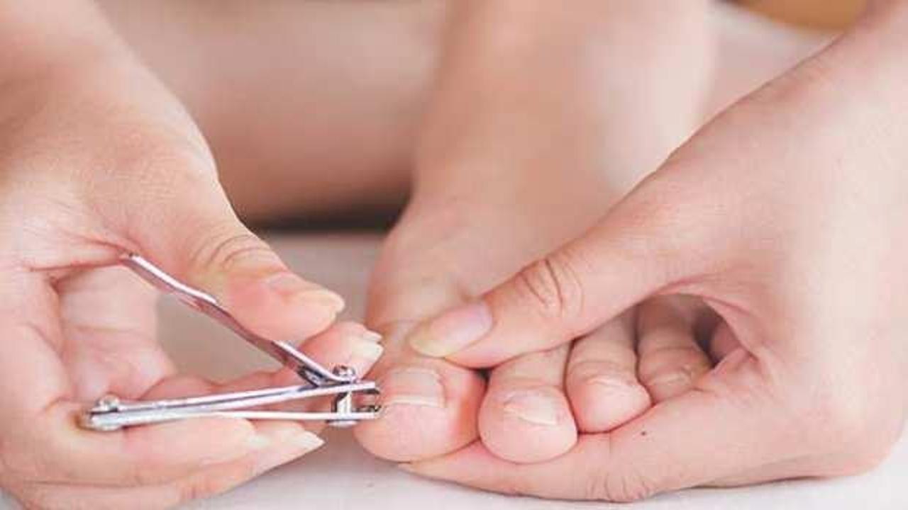 Tırnak batması nasıl geçer? Geçmeyen tırnak batması tedavisi…