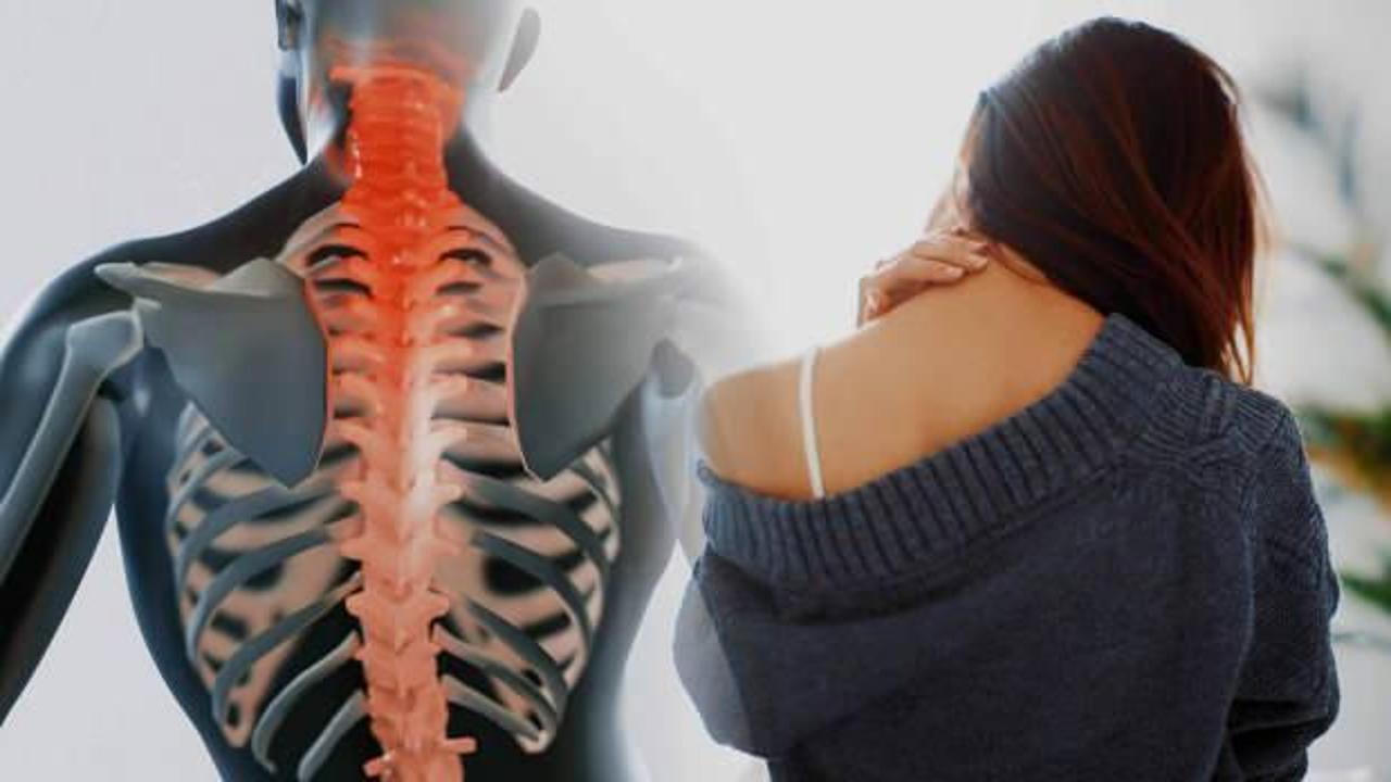 Uzmanında boyun fıtığı ile ilgili uyarı geldi: Cerrahi operasyon gerekebilir!