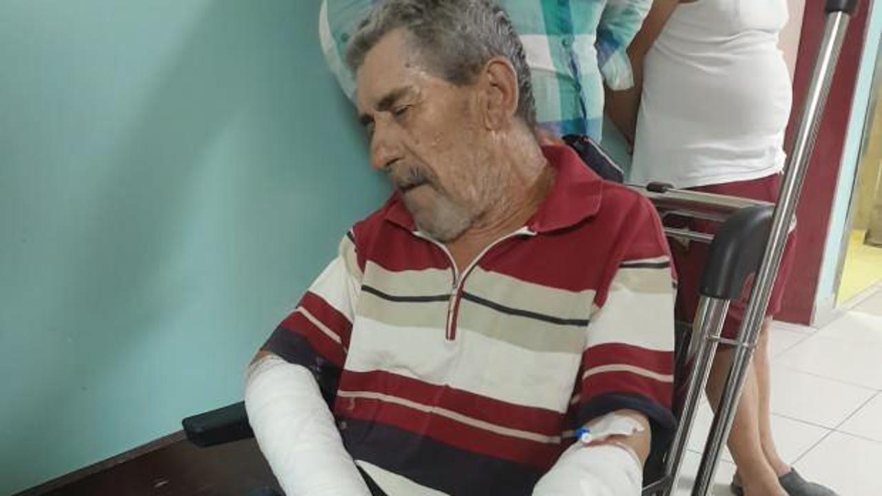 Yaşlı adama köpek saldırısı! 'Kolumdan parça kopardı'