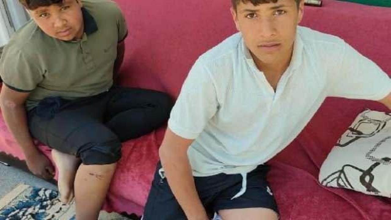 Yine köpek saldırısı! İki çocuk hastaneye kaldırıldı